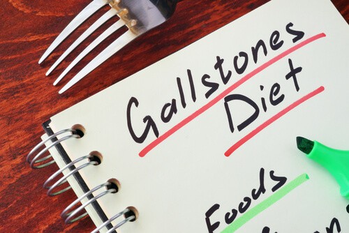 Gallstones After Gastric Sleeve