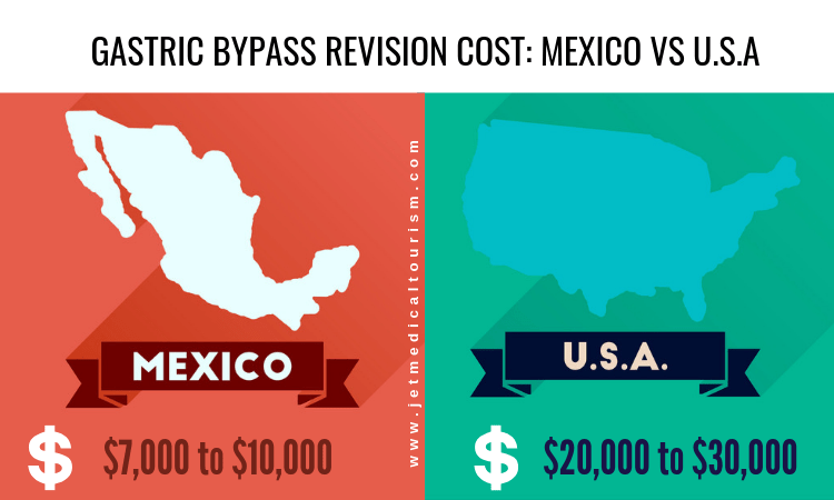 Gastric Bypass Revision Cost Mexico and USA