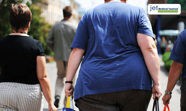 Gastric Bypass for Obese People