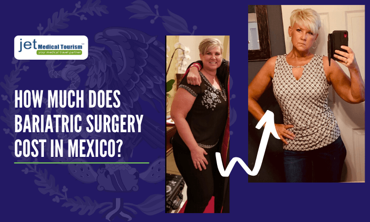 Weight Loss Surgery Cost in Mexico: A Comprehensive Guide