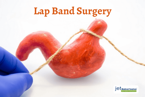 Gastric Lap Band Surgery