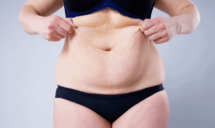 Gastric bypass before and after pictures skin