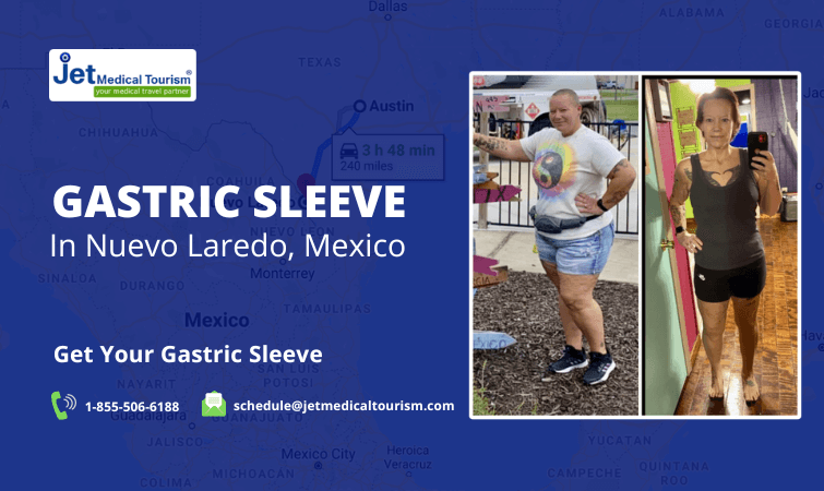 Gastric Sleeve Nuevo Laredo, Mexico