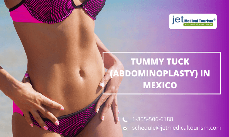 Tummy Tuck (Abdominoplasty) in Mexico