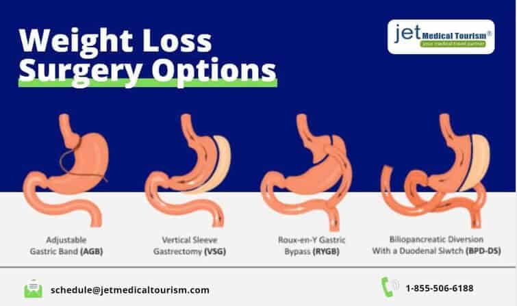 Weight Loss Surgery Options Procedures