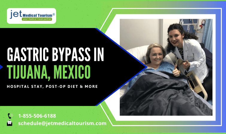 Gastric Bypass Surgery Mexico