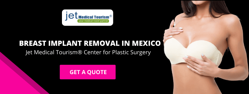 Breast Implant Removal in Mexico