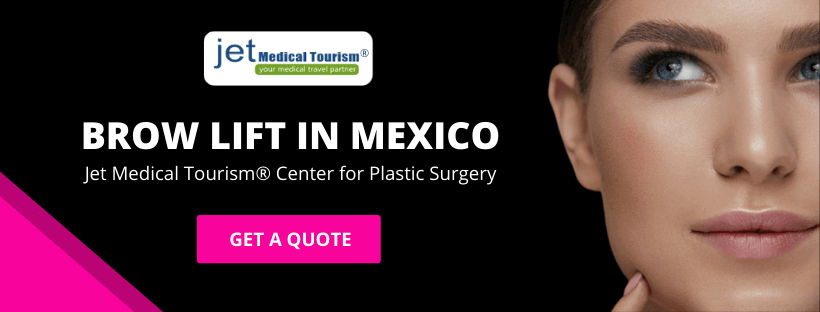 Brow Lift in Mexico