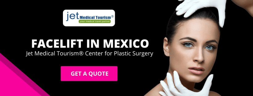 Face Lift in Mexico