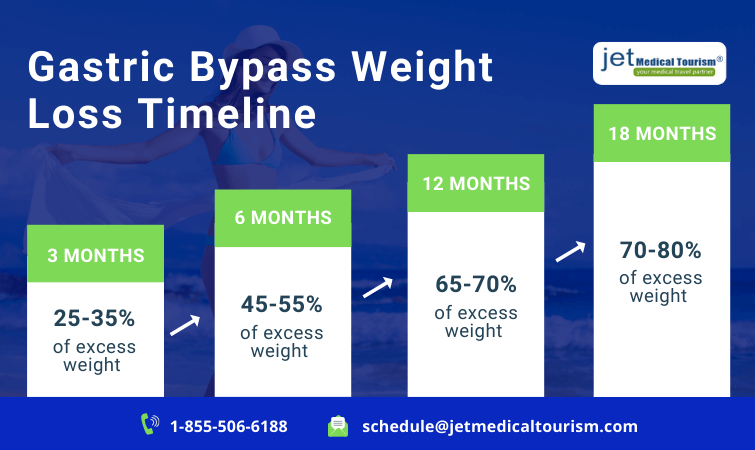 Gastric Bypass Weight Loss Timeline Chart