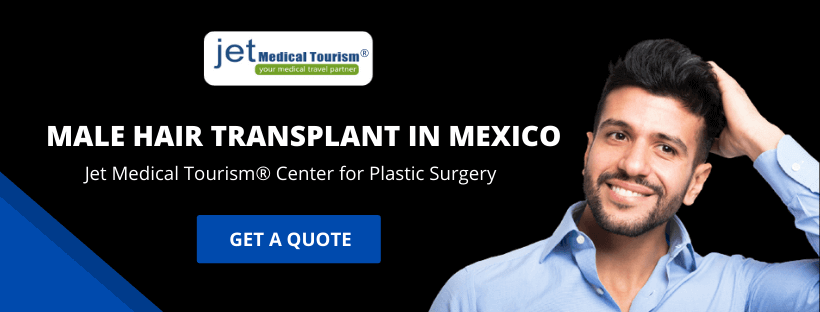 Male Hair Transplant in Mexico