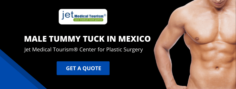 Male Tummy Tuck Mexico