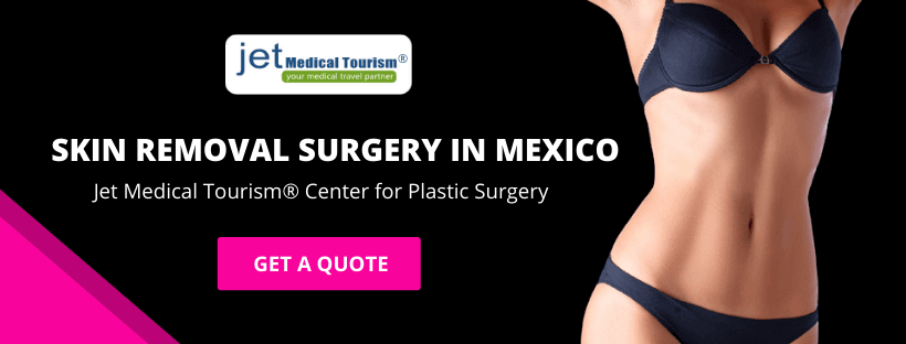 Skin Removal Surgery in Mexico