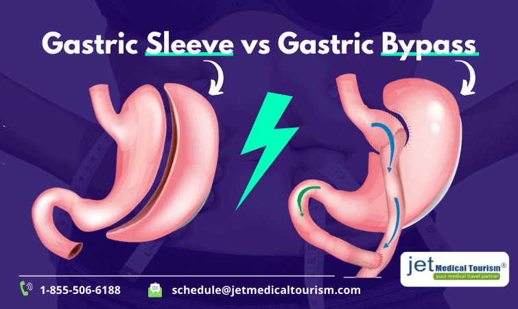 Gastric Sleeve 10 Years Later: Explore Health Outcomes, Insights
