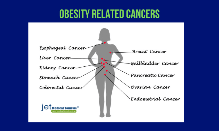 Obesity related cancers