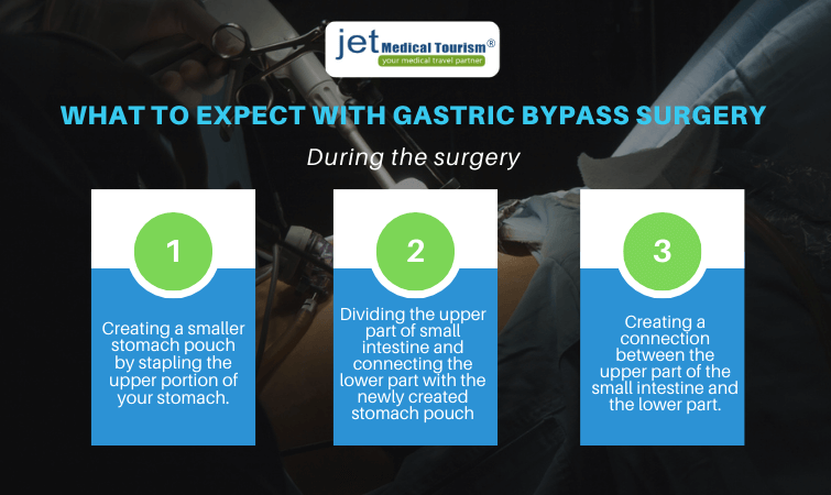 What to expect during gastric bypass surgery