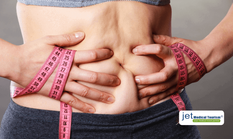 Weight Gain after Gastric Bypass Surgery- What to do?