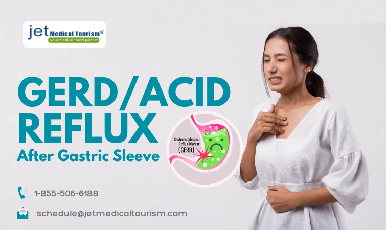 GERD and Acid Reflux after Gastric Sleeve Surgery