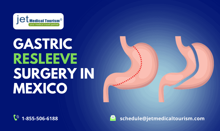 Gastric Resleeve Surgery in Mexico