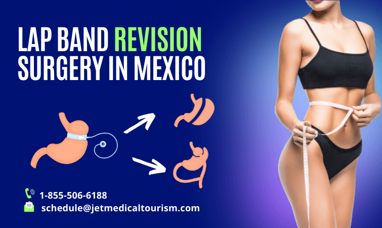 Lap Band Revision Surgery in Mexico