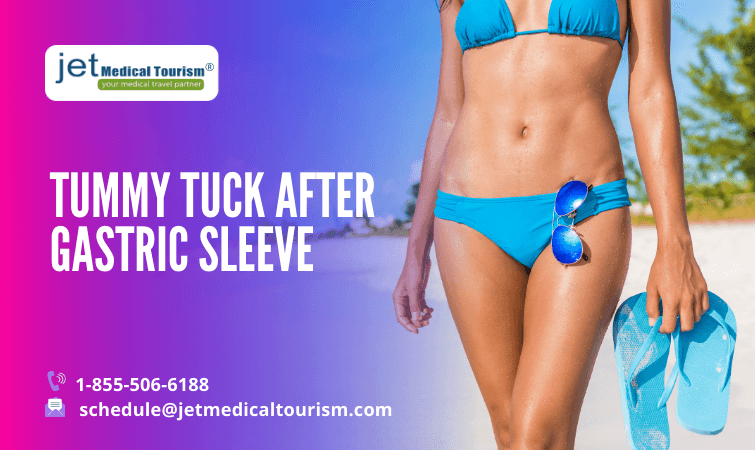 Tummy Tuck After Gastric Sleeve