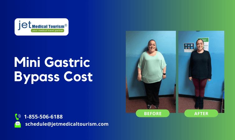 Mini Gastric Bypass Cost