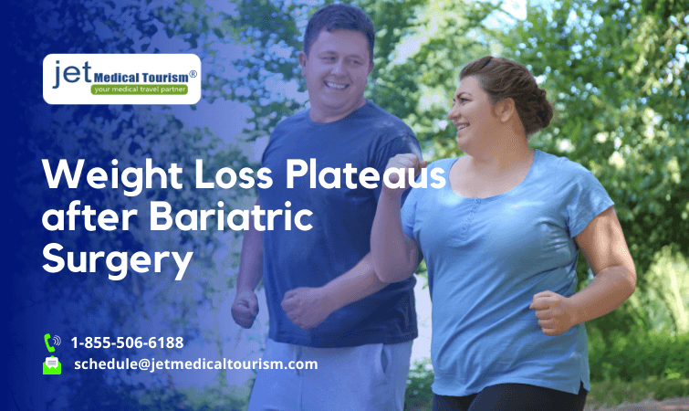 weight loss plateaus after bariatric surgery