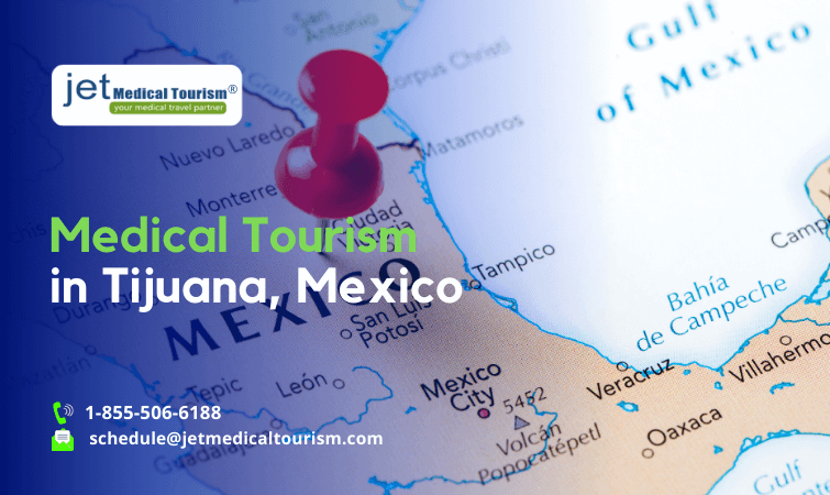 Medical Tourism in Tijuana