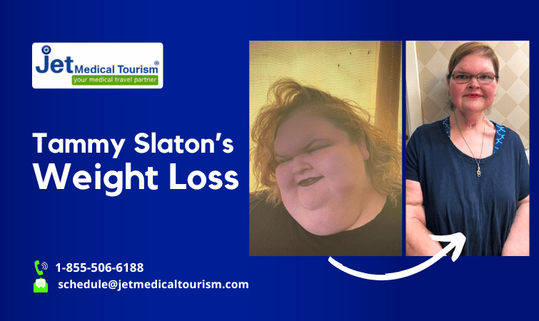 Tammy Slaton Weight Loss Surgery Transformation