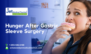 Hunger after Gastric Sleeve Surgery