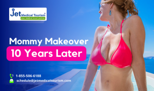 Mommy Makeover 10 Years Later